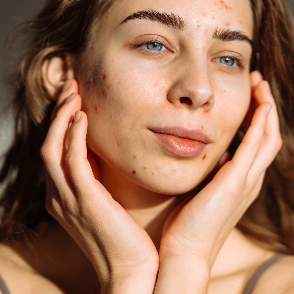Skin Relax Basic Treatment